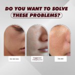 12% AHA + BHA + PHA + LHA Peeling Solution 30ml - Image 3