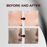 12% AHA + BHA + PHA + LHA Peeling Solution 30ml - Image 7