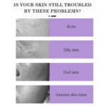 Azelaic Acid Cream 20g - Image 3