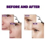 Bakuchiol Serum 30ml - Image 7