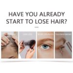 Castor Oil 10ml - Image 3