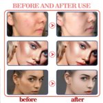 Kojic Acid Facial Wash 100ml - Image 5