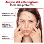 Kojic Acid & Retinol Cream 50g - Image 3