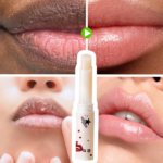 Lip Balm 5g - Image 7