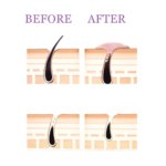 Moisturizing Hair Reducing After Shave Serum 30ml - Image 7