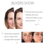 Niacinamide Vitamin B3 Serum 15ml - Image 7